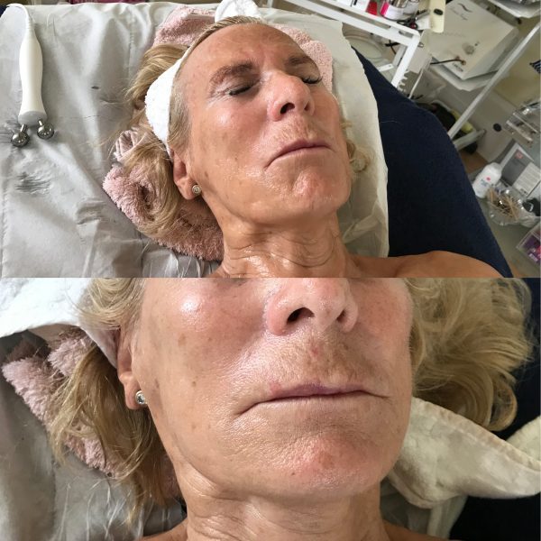 Before-and-After-600x600