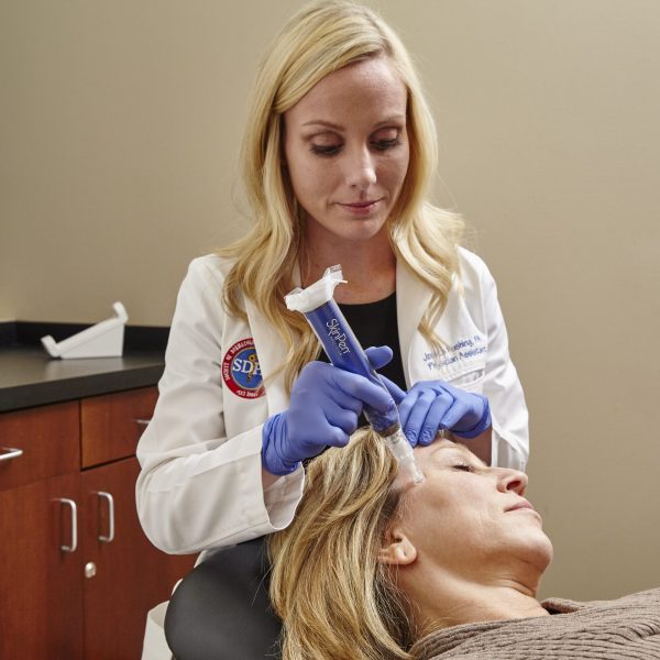 skin pen at osterley skincare 2